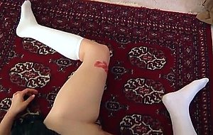 Schoolgirl stabbed  